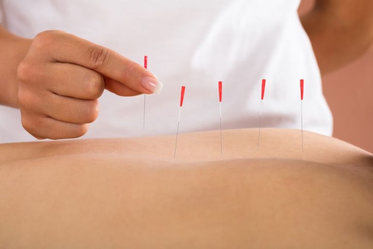 Como montar um consultório de acupuntura – Dicas e Passos